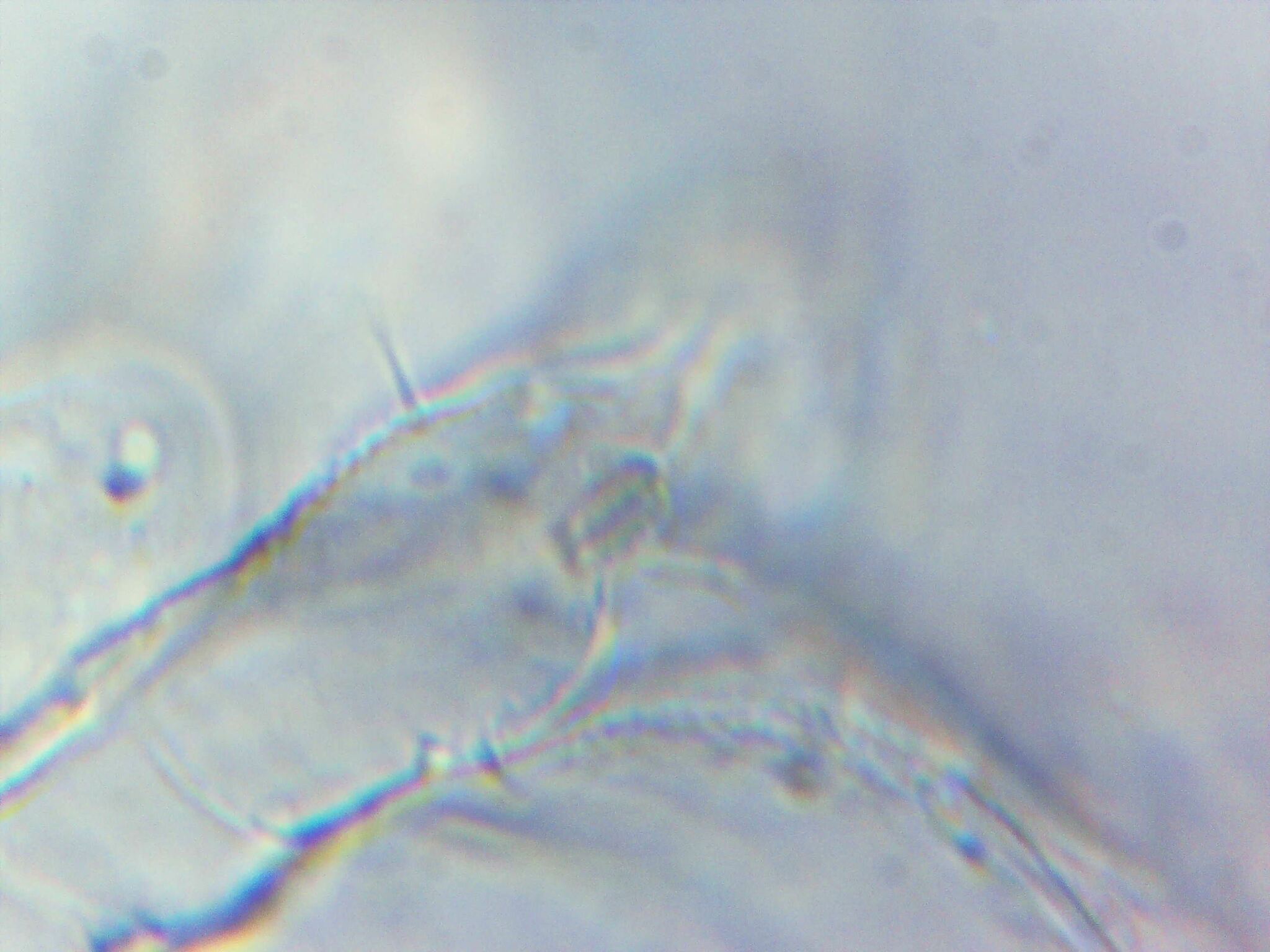 Megalothorax minimus V.Willem, 1900