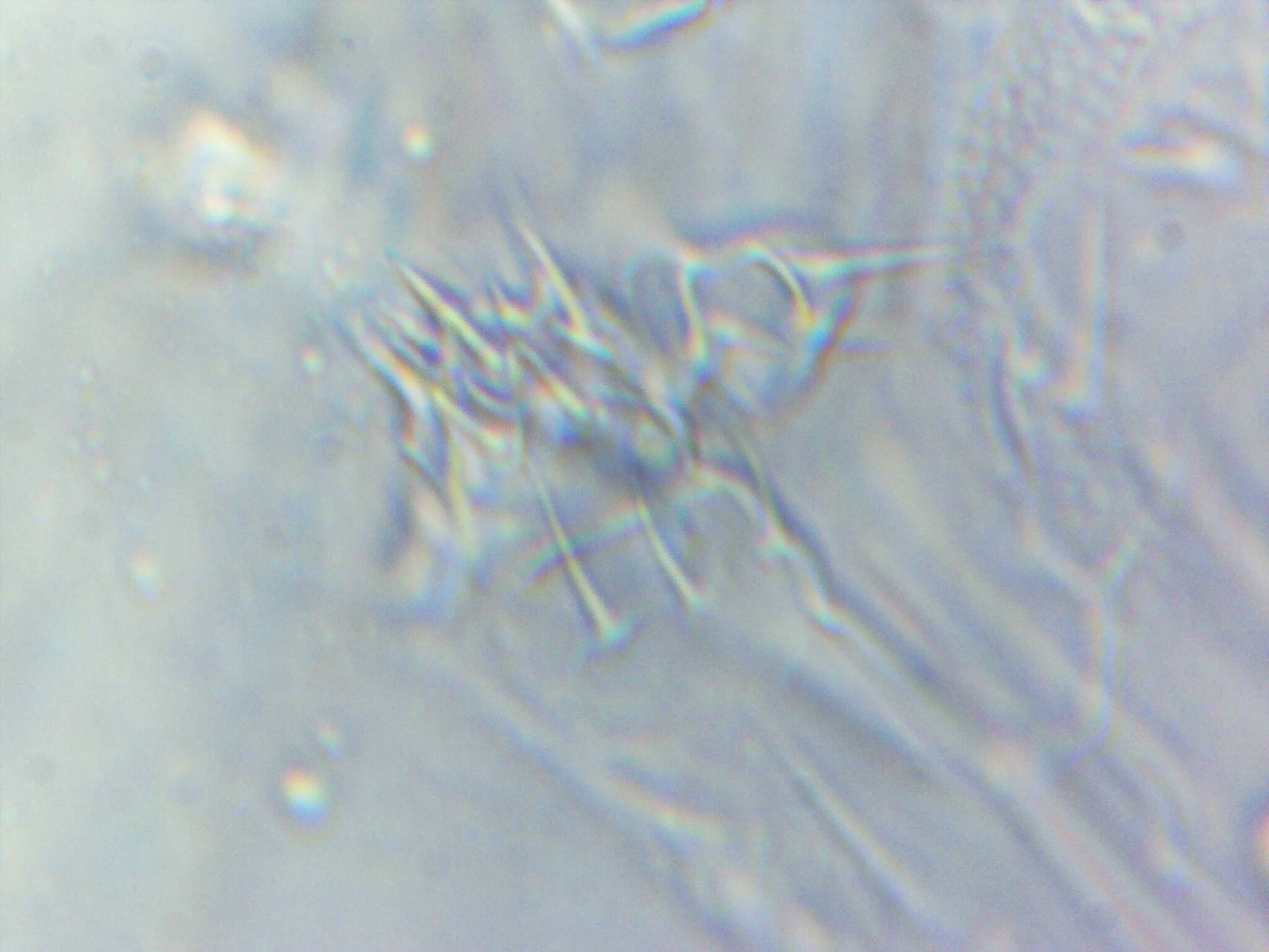 Megalothorax minimus V.Willem, 1900