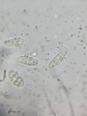 Pleomassariaceae