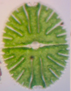 Micrasterias denticulata