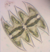 Micrasterias laticeps