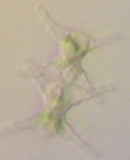 Staurastrum paradoxum