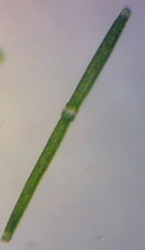 Pleurotaenium trabecula