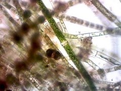 Pleurotaenium trabecula