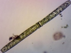 Pleurotaenium archeri