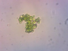 Botryosphaerella sudetica