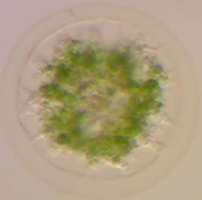 Asterococcus