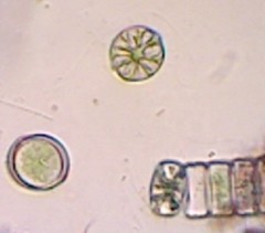 Asterococcus superbus