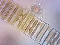 Fragilaria