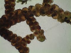 Frullania pentapleura