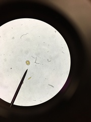 Cocconeis
