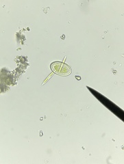 Cocconeis