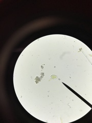 Cocconeis