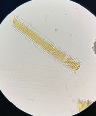 Fragilaria