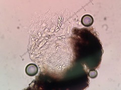 Anisomeridium carinthiacum