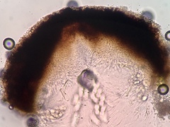 Thelidium pyrenophorum