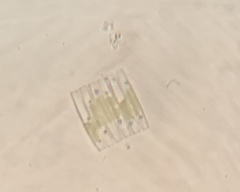 Fragilaria