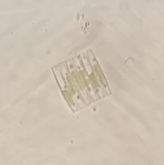 Fragilaria