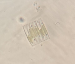 Fragilaria