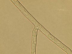 Rhizoctonia solani