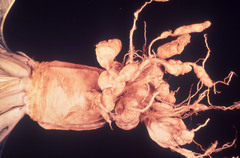 Plasmodiophora brassicae