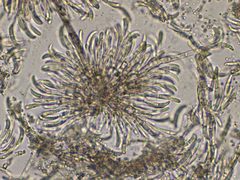 Colletotrichum truncatum