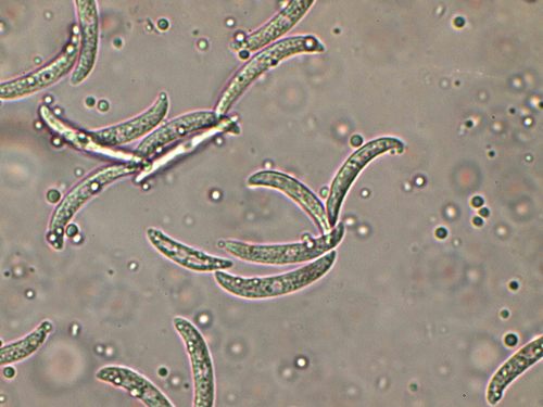Antracnose-da-lentilha