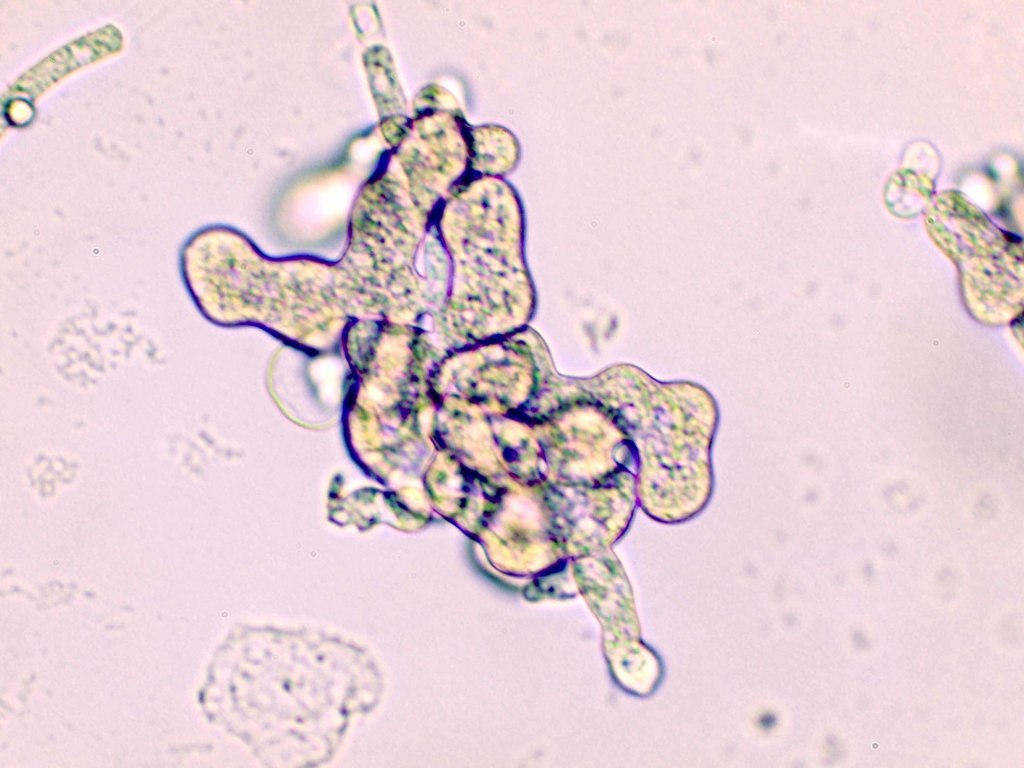 Pythium