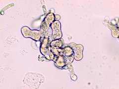 Pythium aphanidermatum