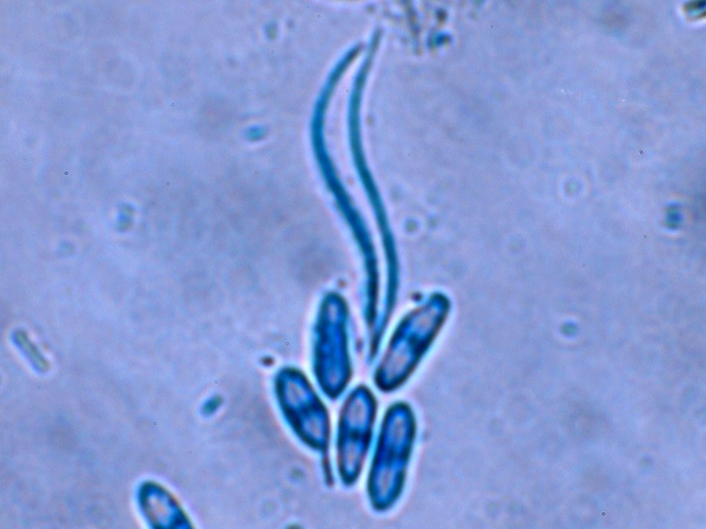 Phomopsis phaseoli