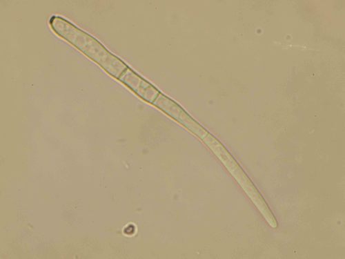 Mancha-púrpura-da-semente