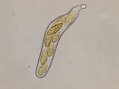 Stemphylium vesicarium