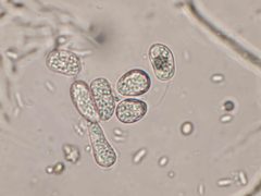 Phyllosticta musarum