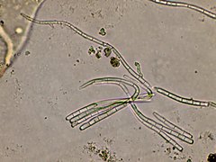 Cercospora chrysanthemi