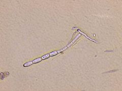 Podosphaera fuliginea