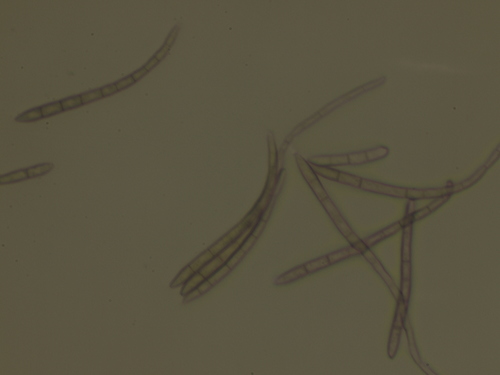 Mancha-foliar-de-cercospora