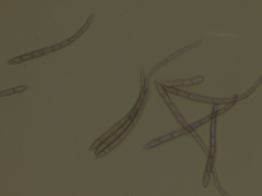 Cercospora physalidis