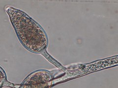 Phytophthora infestans