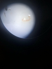 Microtendipes pedellus