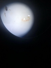 Microtendipes pedellus