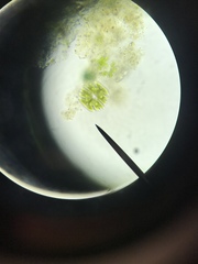 Micrasterias truncata