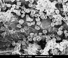 Didymium melanospermum