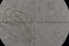 Dacrymyces