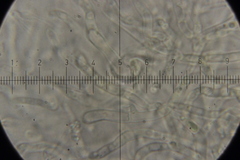 Dacrymyces