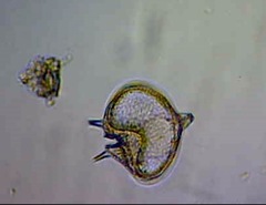 Protoperidinium