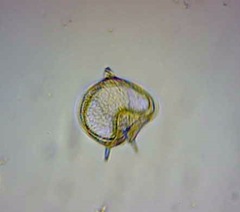Protoperidinium