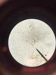 Vorticella campanula