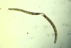 Spirostomum