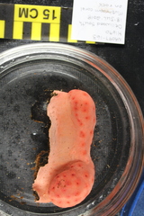 Pseudoanthomastus