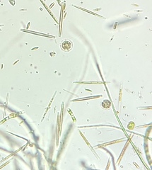 Heliozoa